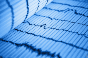 Lees meer over het artikel Wat is een EKG (elektrocardiogram)?