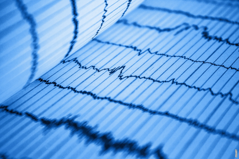 Read more about the article Hvad er en elektrokardiogram (EKG)?