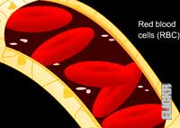 Lees meer over het artikel Hoe ontstaan bloedstolsels?
