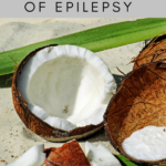 Hvordan behandles epilepsi?